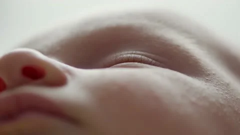 Macro shot of a sleeping childs face affected by diathesis. Troubled face ski Stock Footage 160168440