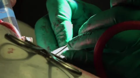 Macro shot of a surgeon performing a complex operation with medical tools. Stock Footage 330247346