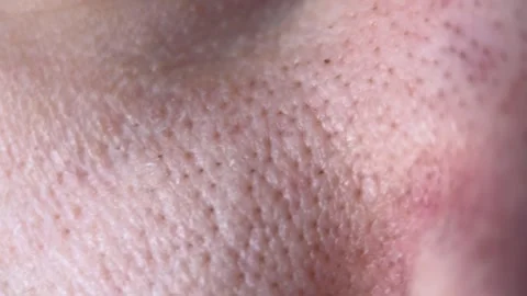 Macro Skin Pore Texture Stock Footage 274206743