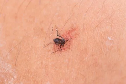 Macro of smashed mosquito Stock Photos