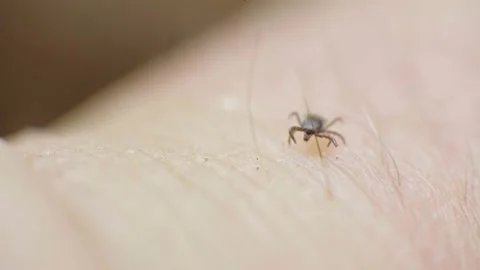 Macro video of crawling small mite on human's skin. Dangerous tick on the skin Stock Footage 156512565
