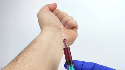 Macro video of a doctor’s hand with a syringe that draws blood from veins on the Stock Footage 125441993