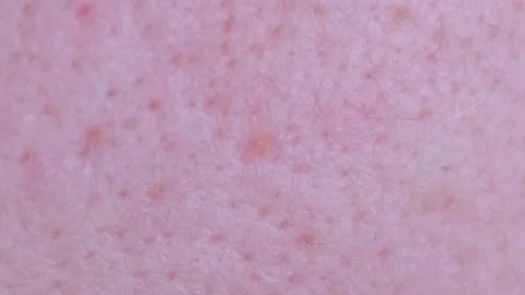 Macro video of problem facial skin of a young guy. Dermatology concept. Vertical Video stock 250114130