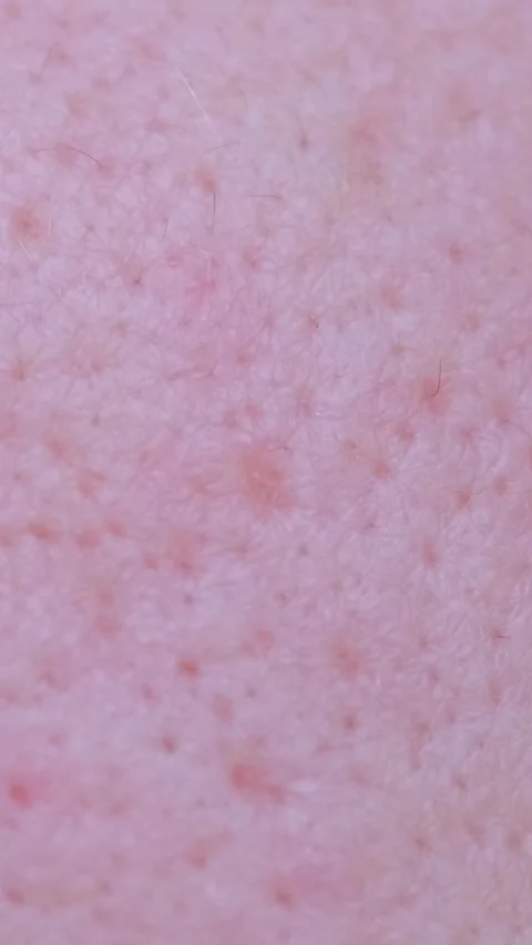 Macro video of problem facial skin of a young guy. Dermatology concept. Vertical Stock Footage 250386301