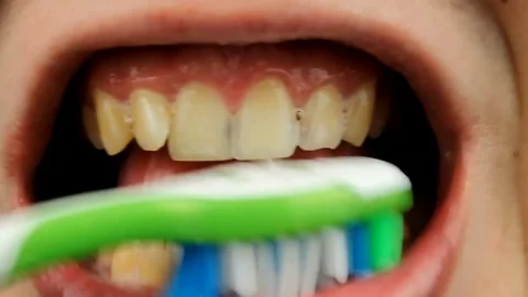 Macro video of yellow teeth during brushing with a toothbrush. Close-up of teeth Stock Footage 84069138
