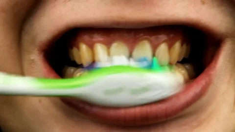 Macro video of yellow teeth during brushing with a toothbrush. Close-up of tooth Stock Footage 84069145