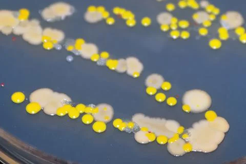 Macro view of bacteria and baker yeast colonies Stock Photos