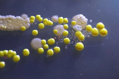 Macro view of bacteria and baker yeast colonies Stock Photos