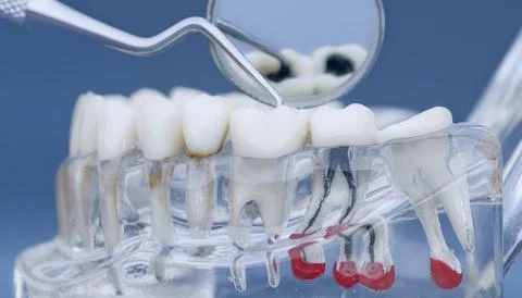 Macro view of dental diagnostic tools checking an artificial transparent jaw  写真素材