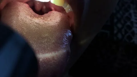 Macro View Examining Sore Throat With Flashlight Stock Footage 338085249