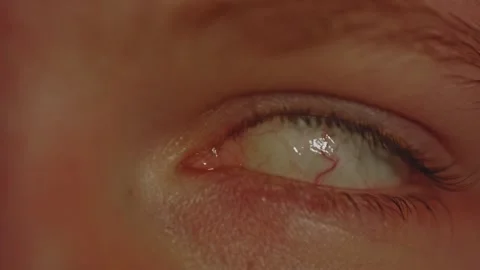 Macro view of eye rolling back in head and turning back Stock Footage 258432277