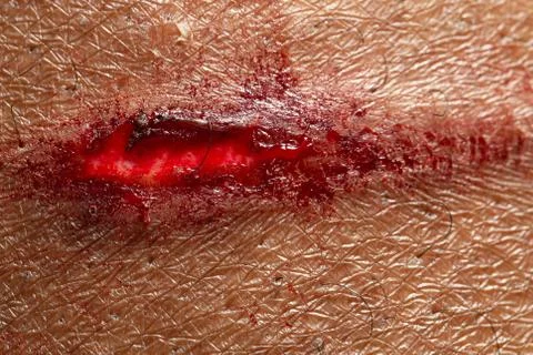 Macro view an open and bleeding cut on human skin 스톡 사진