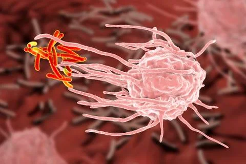 Macrophage engulfing tuberculosis bacteria Stock Illustration