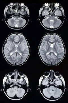 Macrophoto of computer tomography with the brain. Stock Photos