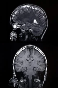 Macrophoto of computer tomography with the brain Stock Photos