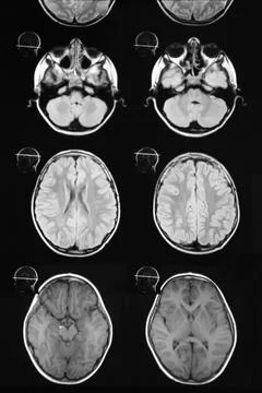 Macrophoto of computer tomography with the brain. Stock Photos