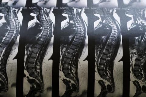 Magnetic computer tomography Stock Photos