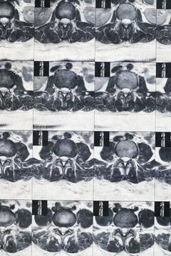 Magnetic computer tomography Stock Photos