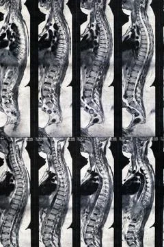 Magnetic computer tomography Stock Photos