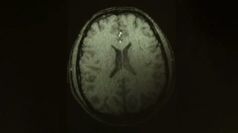 Magnetic resonance imaging Stock Footage 33719978