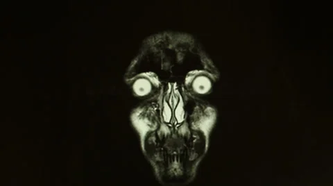 Magnetic resonance imaging Stock Footage 33719985