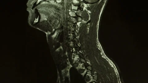 Magnetic resonance imaging Stock Footage 33719996