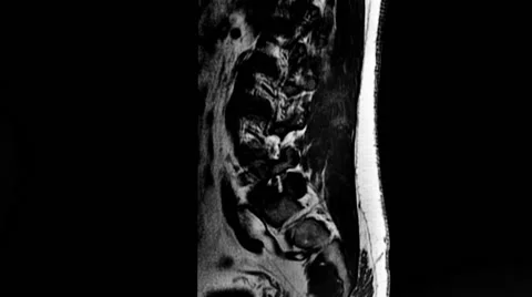 Magnetic resonance imaging Stock Footage 47940347