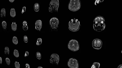 Magnetic Resonance Imaging Stock Footage 59089005