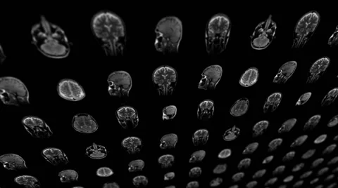 Magnetic Resonance Imaging Stock Footage 59089060
