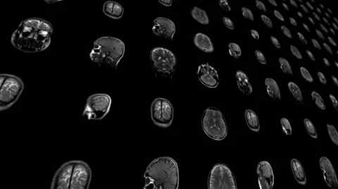 Magnetic Resonance Imaging Stock Footage 59089129