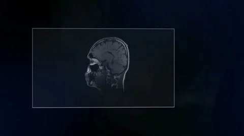 Magnetic Resonance Imaging Stock Footage 59089191