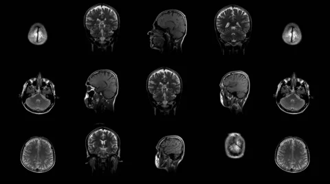 Magnetic Resonance Imaging Stock Footage 59089500
