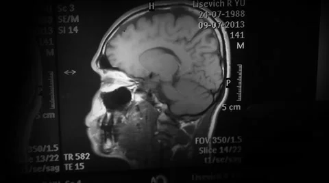 Magnetic Resonance Imaging Stock Footage 59305960