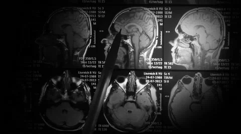 Magnetic Resonance Imaging Stock Footage 59305970