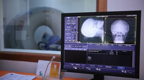 Magnetic resonance imaging. Human brain. Stock Footage 36620308