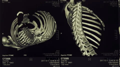 Magnetic resonance imaging (MRI) of the ... | Stock Video | Pond5