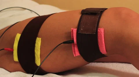 Magnetic Therapy 스톡 동영상 27843392