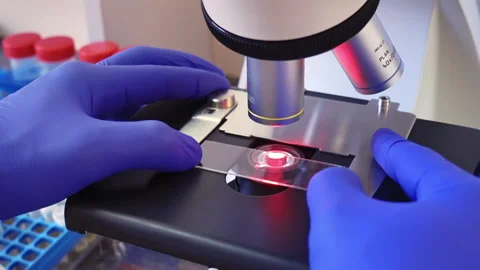 Magnification under a microscope in a clinic laboratory Stock Footage 202858272