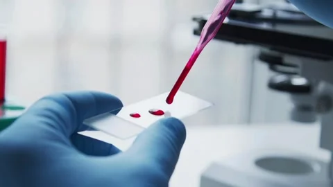 A magnified view of a bird flu virus, studied in a laboratory by experts. Stock Footage 336583503