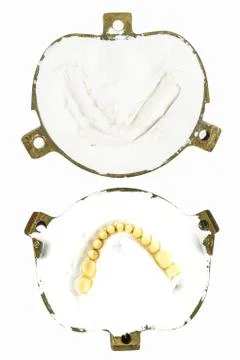 Make denture plaster model Stock Photos