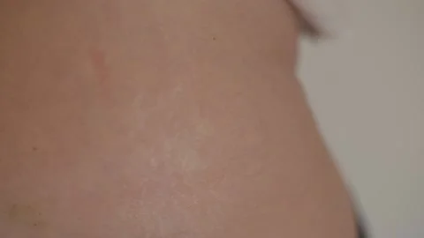 Makes an injection to himself, intramuscular injection of the vaccine, urgently  Vídeo Stock 146664723