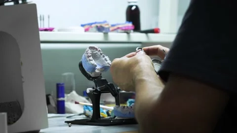 Making a dental crown. laboratory. close-up Stock Footage 207785513