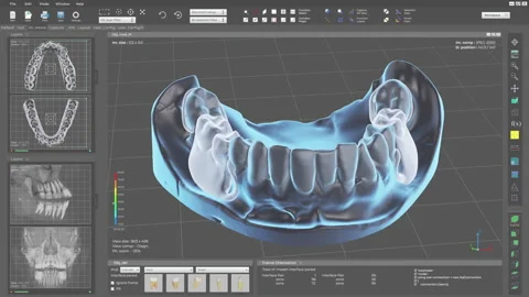 Making a Dentistry project using specialised 3D visualisation software UI Stock Footage 309956760