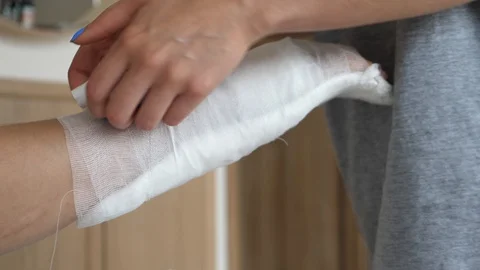 Making splint on broken arm Stock Footage 109499947