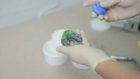 Making a template for temporary veneers. Dental high productivity models printed 스톡 동영상 194461723