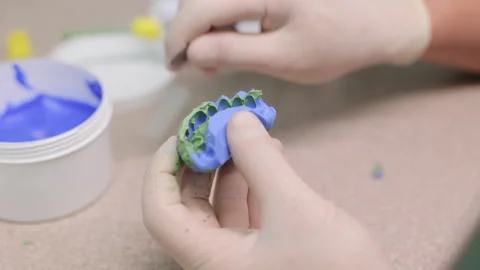 Making a template for temporary veneers with A-silicone. Dentist work in modern Stock Footage 194461780