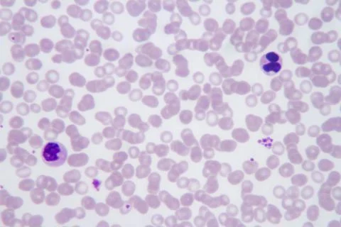 Malaria parasite Plasmodium vivax Stock Photos