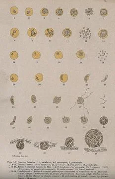 Malaria parasites seen through a microscope. Colour lithograph after R. Fie.. Stock Illustration