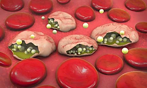 Malaria pathogen causing malaria illness, infected blood cell Stock Illustration