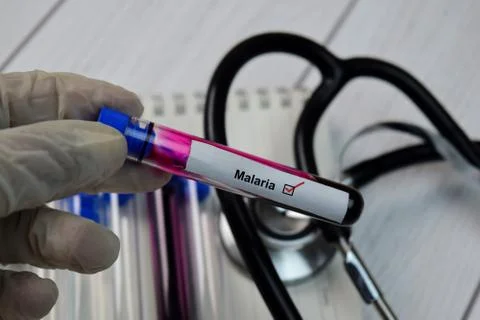 Malaria Test text with blood sample. Top view isolated on black background. Stock Photos